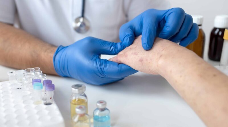 OPS alerta sobre incremento de casos de sarampión en Américas