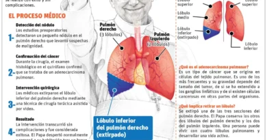 Fue exitosa operación al Papa sobre un cáncer en el pulmón
